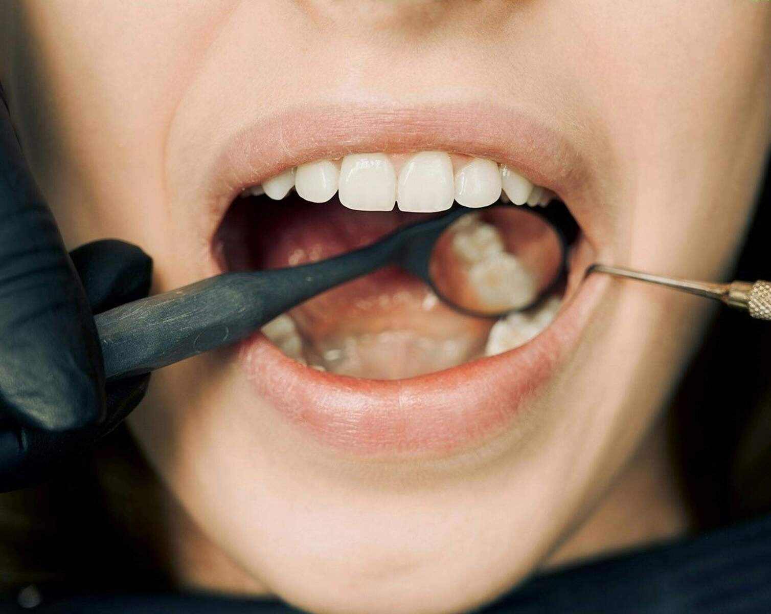 Consejos de higiene oral: cómo mantener tus dientes sanos y fuertes