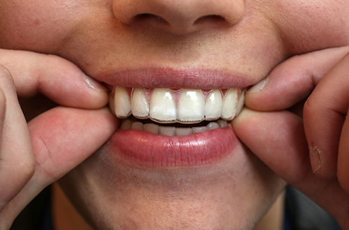 Ortodoncia en Madrid